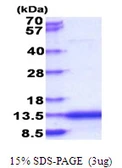 Human CAMK2N2 protein, His tag. GTX57281-pro