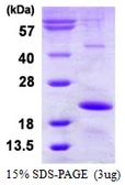 Human HSPB9 protein, His tag. GTX57282-pro