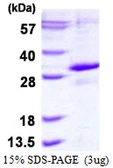 Human PHD3 protein, His tag. GTX57288-pro