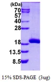 Human SAT2 protein, His tag. GTX57289-pro