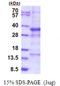 Human GTF3C6 protein, His tag. GTX57291-pro