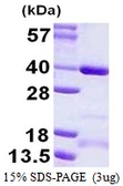 Human CCDC101 protein, His tag. GTX57292-pro