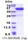 Human CCDC104 protein, His tag. GTX57293-pro