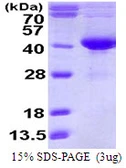 Human SDSL protein, His tag. GTX57294-pro