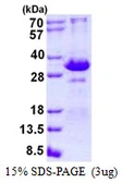 Human TIRAP protein, His tag. GTX57295-pro