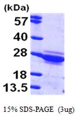 Human Cytoglobin protein, His tag. GTX57296-pro