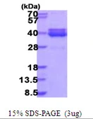 Human NT5C3L protein, His tag. GTX57298-pro