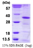 Human HAUS1 protein, His tag. GTX57299-pro