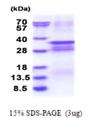 Human OSR2 protein, His tag. GTX57302-pro