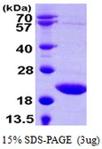 Human TSEN15 protein, His tag. GTX57306-pro