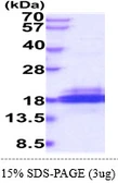 Human SH2D1B protein, His tag. GTX57307-pro