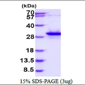 Human GSTO2 protein, His tag. GTX57308-pro