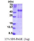 Human PIH1D2 protein, His tag. GTX57309-pro