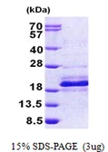 Human DPH4 protein, His tag. GTX57310-pro