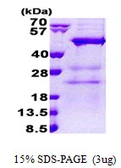 Human NAT12 protein, His tag. GTX57313-pro