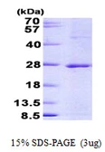 Human JDP2 protein, His tag. GTX57314-pro