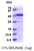Human AGPHD1 protein, His tag. GTX57316-pro