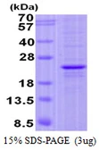 Human FOPNL protein, His tag. GTX57317-pro
