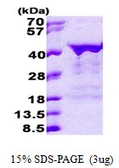 Human Musashi 2 protein, His tag. GTX57318-pro