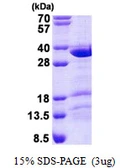 Human CCDC43 protein, His tag. GTX57321-pro