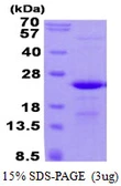 Human C17orf49 protein, His tag. GTX57322-pro