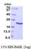 Human Hsp20 protein, His tag. GTX57324-pro