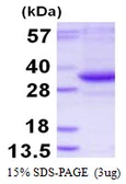 Human TATDN3 protein, His tag. GTX57326-pro