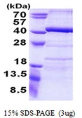 Human LIAR protein, His tag. GTX57327-pro