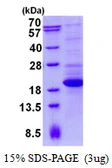Human TTC32 protein, His tag. GTX57329-pro