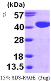Human GALM protein, His tag. GTX57330-pro