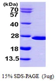 Human NUDT16 protein, His tag. GTX57331-pro