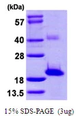 Human SNTN protein, His tag. GTX57332-pro