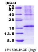 Human OCIAD2 protein, His tag. GTX57333-pro