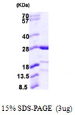Human Capsl protein, His tag. GTX57335-pro