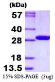 Human CMBL protein, His tag. GTX57336-pro