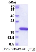 Human NUDCD2 protein, His tag. GTX57337-pro