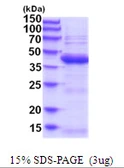 Human UBLCP1 protein, His tag. GTX57338-pro