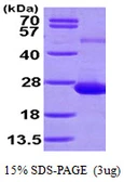 Human ADAT2 protein, His tag. GTX57339-pro