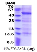 Human MAGEB10 protein, His tag. GTX57342-pro