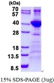 Human NEK7 protein, His tag. GTX57347-pro