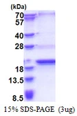 Human SCP2D1 protein, His tag. GTX57352-pro