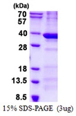 Human BCDIN3D protein, His tag. GTX57354-pro