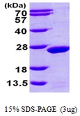 Human MDP1 protein, His tag. GTX57357-pro