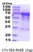 Human TOM1L2 protein, His tag. GTX57358-pro