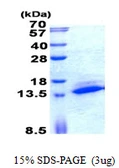 Human SAMD13 protein, His tag. GTX57360-pro