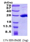 Human COMMD7 protein, His tag. GTX57362-pro
