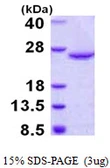 Human DUSP18 protein, His tag. GTX57363-pro