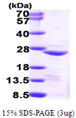 Human COMMD1 protein, His tag. GTX57364-pro
