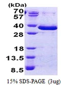 Human FAM84A protein, His tag. GTX57365-pro