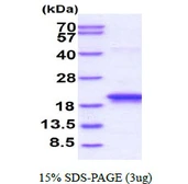Human GLIPR2 protein, His tag. GTX57366-pro